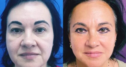 galerie-facelift-v3-01-860x822x0x114x860x592x1636448939