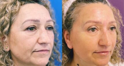 galerie-facelift-v3-06-860x860x0x26x860x706x1636448939
