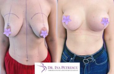 galerie-masto-implant-v3-03-430x325x0x52x430x273x1636448939