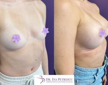 marire-implant-jan-2023-15-430x351x0x60x430x291x1675266679