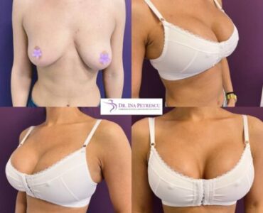 marire-implant-jan-2023-3-430x430x0x0x430x430x1675266663