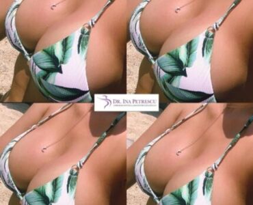 marire-implant-jan-2023-4-464x464x17x0x430x464x1675266665