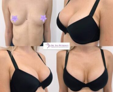 marire-implant-jan-2023-6-430x430x0x6x430x417x1675266668