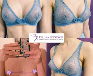 marire-sani-gallery-005-904x904x22x0x860x904x1636448939