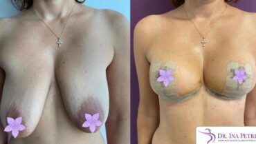 masto-fara-implant-gallery-001-430x234x0x13x430x209x1636448939
