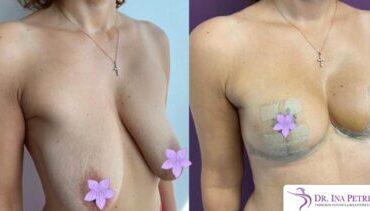 masto-fara-implant-gallery-002-430x234x0x12x430x211x1636448939