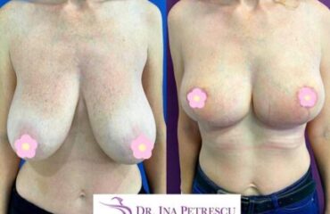 masto-fara-implant-gallery-005-430x321x0x5x430x311x1636448939