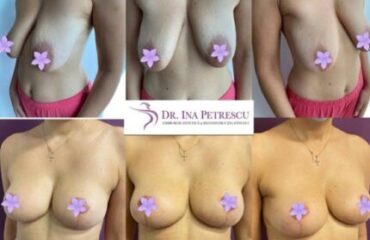 masto-fara-implant-gallery-006-430x369x0x28x430x314x1636448939