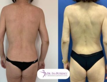 total-body-gallery-003-456x305x13x0x430x305x1636448939