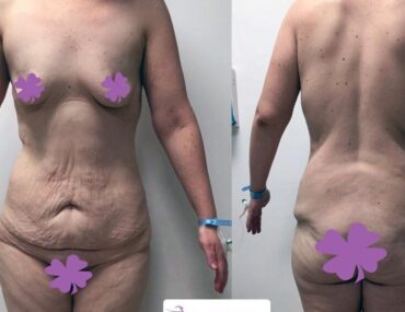 total-body-gallery-006-1170x778x154x0x860x778x1636448939