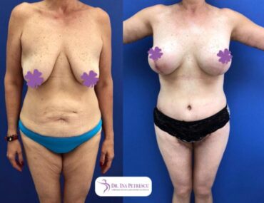 total-body-gallery-008-860x640x0x6x860x634x1636448939