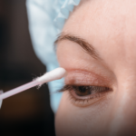 Blefaroplastie