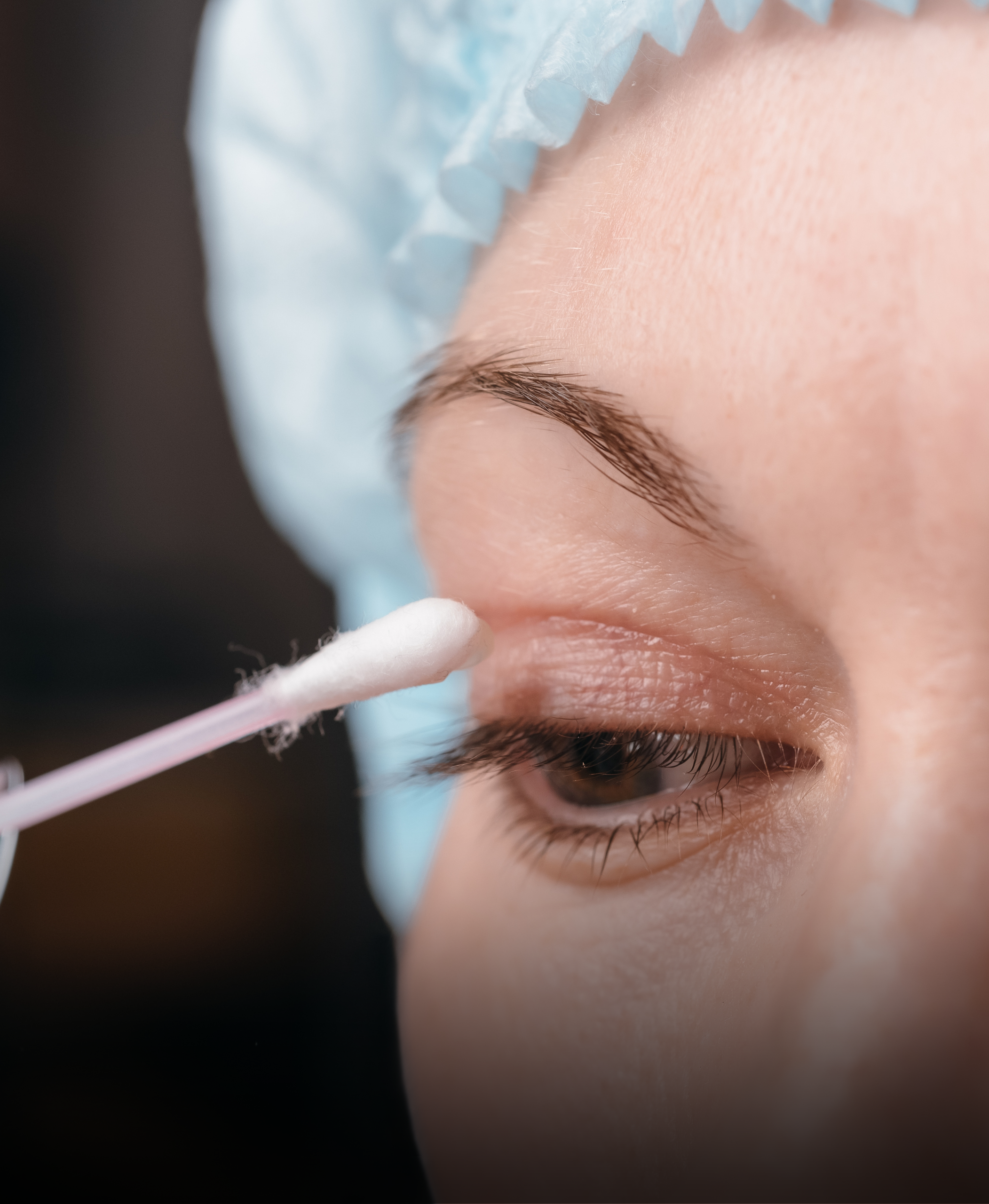What are tired eyes hiding? Discover the solution of blepharoplasty