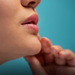 Lip Lift