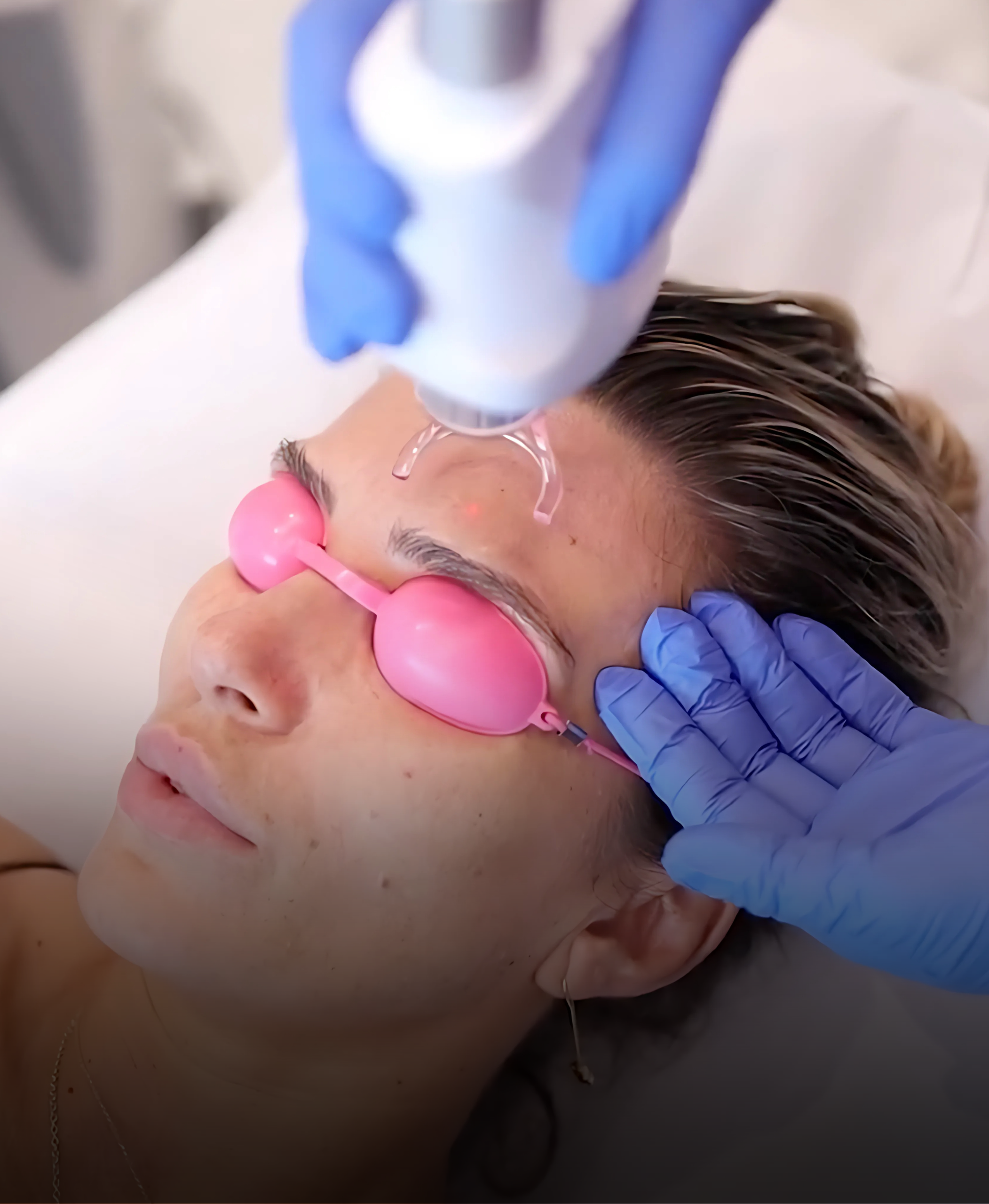 Wrinkles, spots, scars? Effective methods for perfect skin before summer