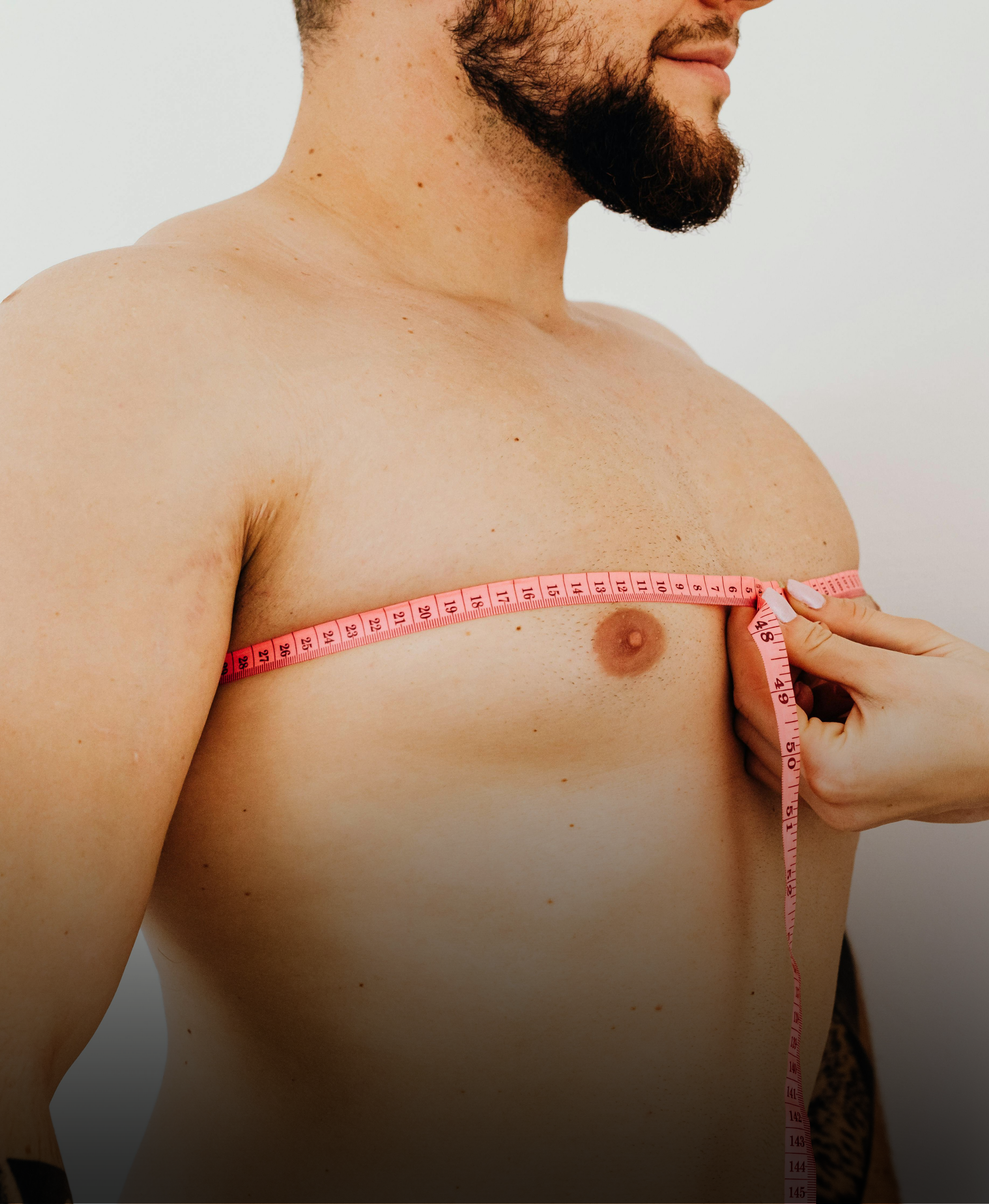 More than aesthetics: A necessary discussion about gynecomastia